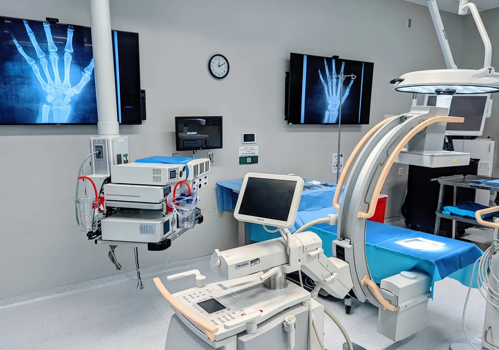 CAMLS A modern medical room with advanced equipment including monitors displaying X-ray images of a hand, surgical machines, a mobile C-arm, and a surgical table. The room is well-lit and organized, suggesting it's prepared for a surgical procedure.